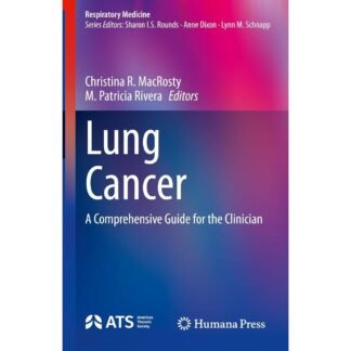 Lung Cancer - A Comprehensive Guide for the Clinician 2023