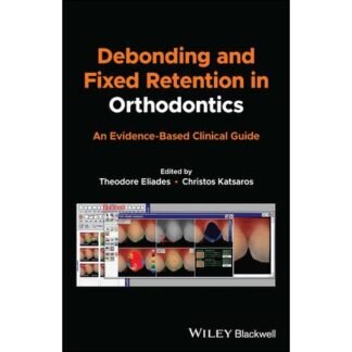 [Full Color/BW] Debonding and Fixed Retention in Orthodontics 2024