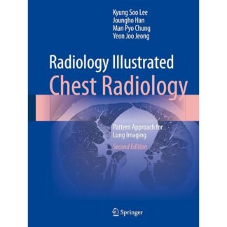 [Full Color/BW[ Radiology Illustrated Chest Radiology Pattern Approach for Lung Imaging 2e 2023