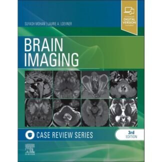 [Full Color/BW] Brain Imaging  Case Review Series, 3e 2024
