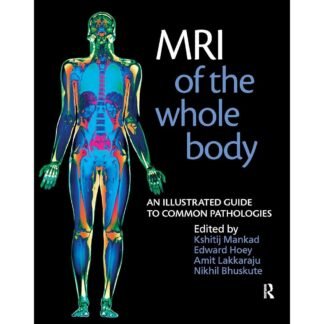 MRI of the Whole Body 2011