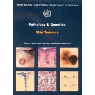 [Full Color/BW] WHO Pathology and Genetics Skin Tumors