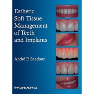 Esthetic Soft Tissue Management of Teeth and Implants 3e 2013