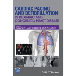 Cardiac Pacing and Defibrillation in Pediatric Congenital Heart Diseases 2017