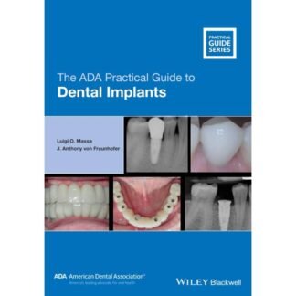 The ADA Practical Guide to Dental Implants 2021