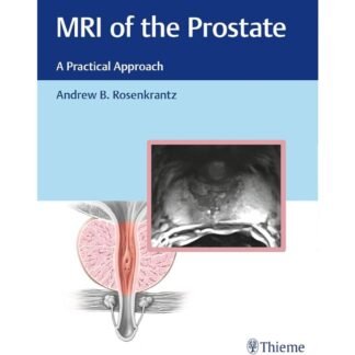 [Full Color/BW] MRI of the Prostate a Practical Approach 2024