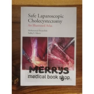 [Full Color /BW]  Safe Laparoscopic Cholecystectomy An Illustrated Atlas 2021