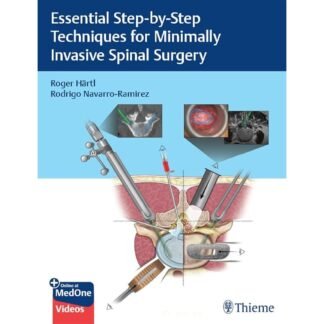 [Full Color/BW] Essential Step-By-Step Techniques for Minimally Invasive Spinal Surgery 2022
