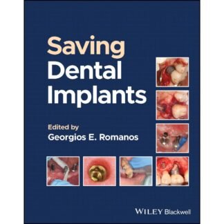 [Full Color/BW] Saving Dental Implants 2024