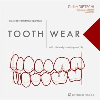 [Full Color/BW] Tooth Wear Didier Dietschi 2023