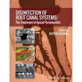 [Full Color/BW] Disinfection of Root Canal Systems 2014