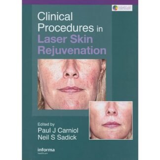 [Full Color/BW] Clinical Procedures in Laser Skin Rejuvenation