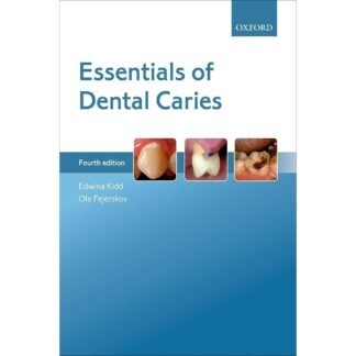 [Full Color/BW] Essentials of Dental Caries 4e 2016