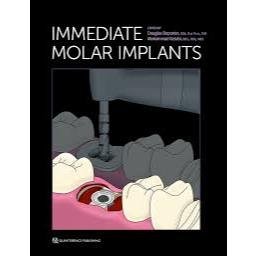 [Full COlor/BW] Immediate Molar Implants 2023