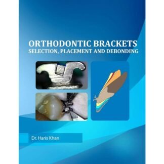 Orthodontic brackets selection, placement and debonding 2016