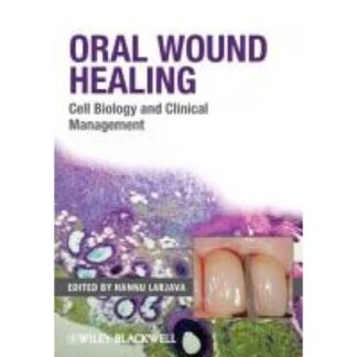 [Full Color /BW] Oral Wound Healing Cell Biology and Clinical Management 2012