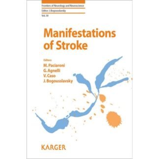 [Full Color /BW] Manifestations of Stroke vol 30 2012